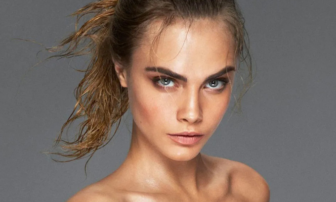 Siêu mẫu Cara Delevingne vượt mặc cảm bệnh vảy nến