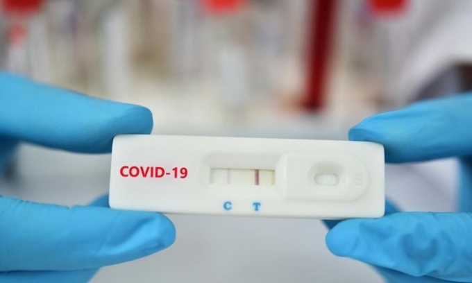 Test nhanh vạch mờ có phải Covid nhẹ?